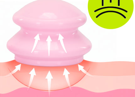 Actiget® Cellulitis Cups - Cellulitis Cupping - Cupping Set - Cupping Massage - Voor Gezicht, Armen en Benen - Vacuüm - Roze - 4 Stuks