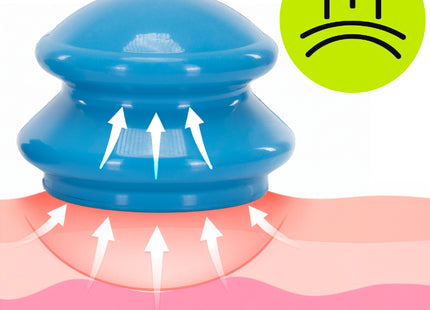 Actiget® Cellulitis Cups - Cellulitis Cupping - Cupping Set - Cupping Massage - Voor Gezicht, Armen en Benen - Vacuüm - Blauw- 4 Stuks